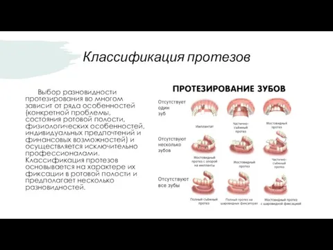 Классификация протезов Выбор разновидности протезирования во многом зависит от ряда особенностей (конкретной