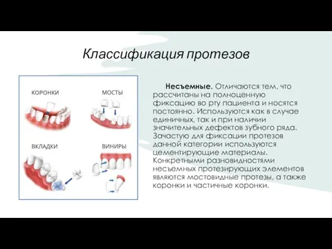 Классификация протезов Несъемные. Отличаются тем, что рассчитаны на полноценную фиксацию во рту