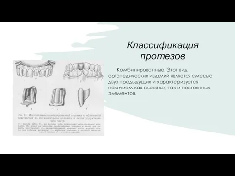 Классификация протезов Комбинированные. Этот вид ортопедических изделий является смесью двух предыдущих и