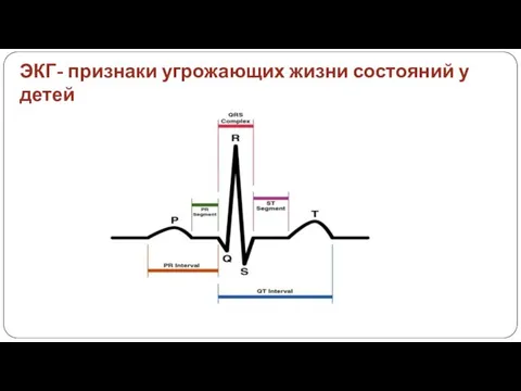 ЭКГ- признаки угрожающих жизни состояний у детей