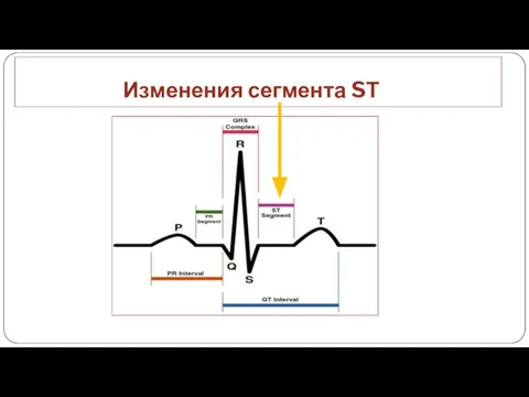 Изменения сегмента SТ