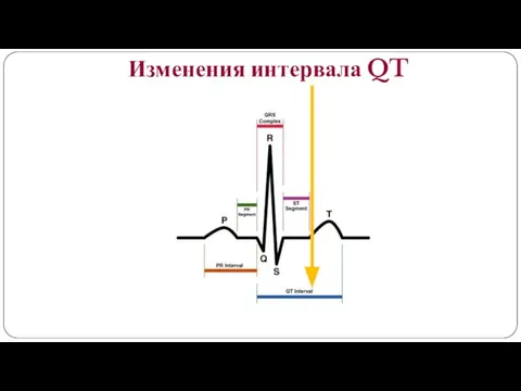 Изменения интервала QT