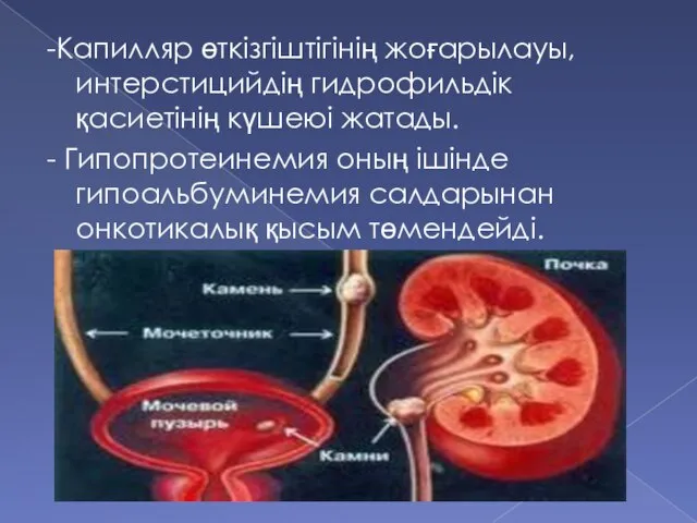 -Капилляр өткізгіштігінің жоғарылауы, интерстицийдің гидрофильдік қасиетінің күшеюі жатады. - Гипопротеинемия оның ішінде