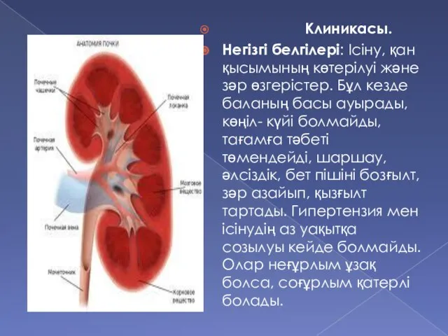 Клиникасы. Негізгі белгілері: Ісіну, қан қысымының көтерілуі және зәр өзгерістер. Бұл кезде