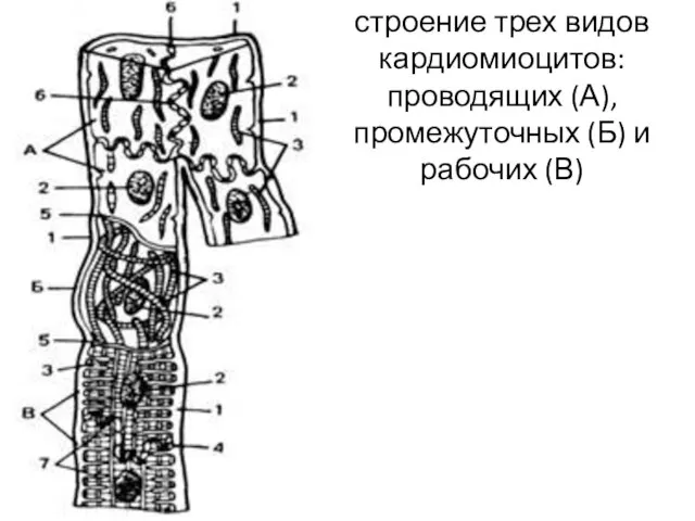 строение трех видов кардиомиоцитов: проводящих (А), промежуточных (Б) и рабочих (В)