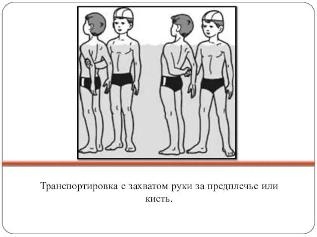 Транспортировка с захватом руки за предплечье или кисть.