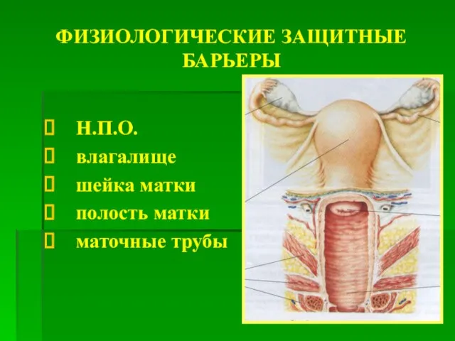 ФИЗИОЛОГИЧЕСКИЕ ЗАЩИТНЫЕ БАРЬЕРЫ Н.П.О. влагалище шейка матки полость матки маточные трубы