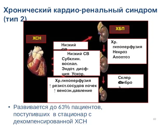 Хронический кардио-ренальный синдром (тип 2) Развивается до 63% пациентов, поступивших в стационар