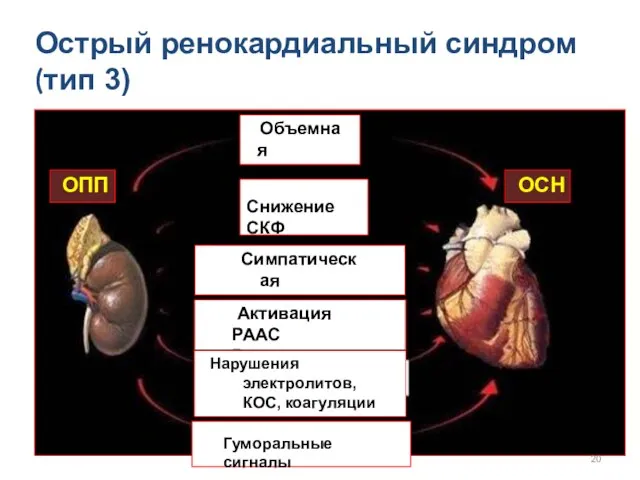 Острый ренокардиальный синдром (тип 3) ОПП ОСН Объемная перегрузка Снижение СКФ Симпатическая