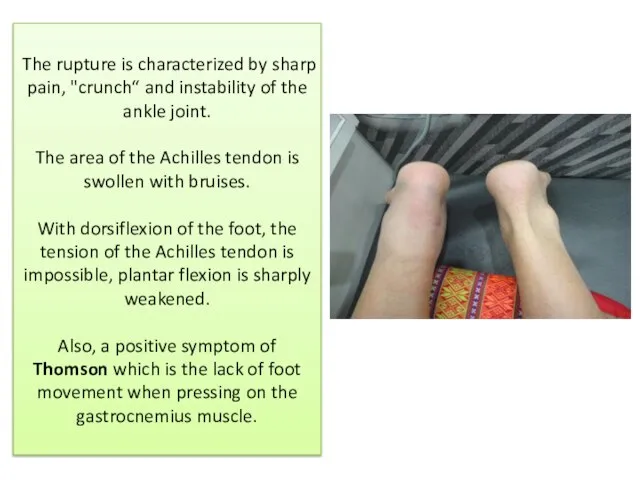 The rupture is characterized by sharp pain, "crunch“ and instability of the