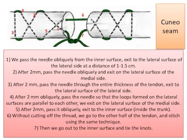 1) We pass the needle obliquely from the inner surface, exit to