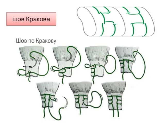 шов Кракова