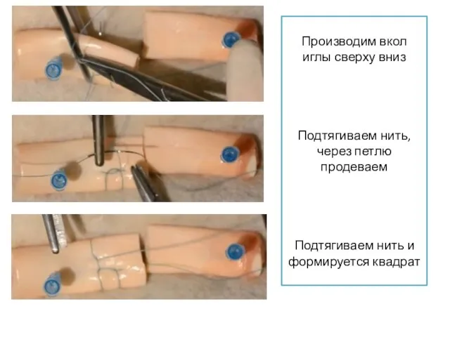 Производим вкол иглы сверху вниз Подтягиваем нить, через петлю продеваем Подтягиваем нить и формируется квадрат