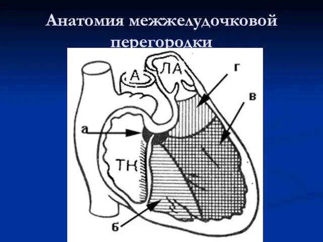 Анатомия межжелудочковой перегородки