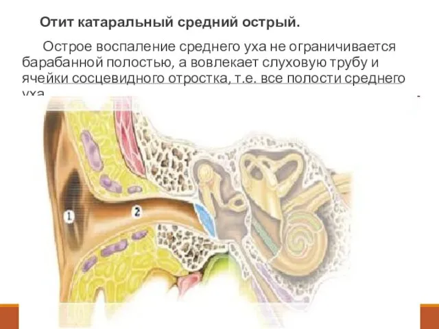 Отит катаральный средний острый. Острое воспаление среднего уха не ограничивается барабанной полостью,