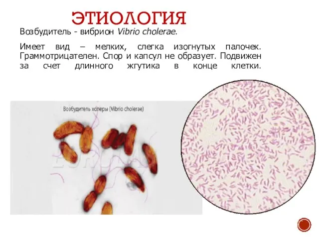 ЭТИОЛОГИЯ Возбудитель - вибрион Vibrio cholerae. Имеет вид – мелких, слегка изогнутых