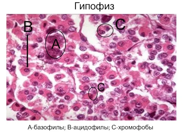 Гипофиз А-базофилы; В-ацидофилы; С-хромофобы А В С С