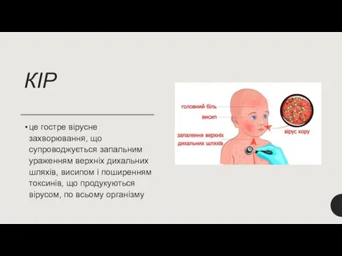 КІР це гостре вірусне захворювання, що супроводжується запальним ураженням верхніх дихальних шляхів,