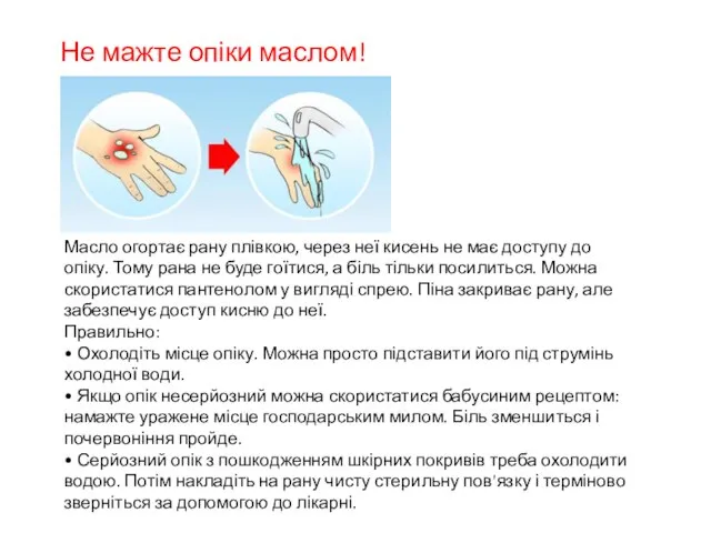 Не мажте опіки маслом! Масло огортає рану плівкою, через неї кисень не