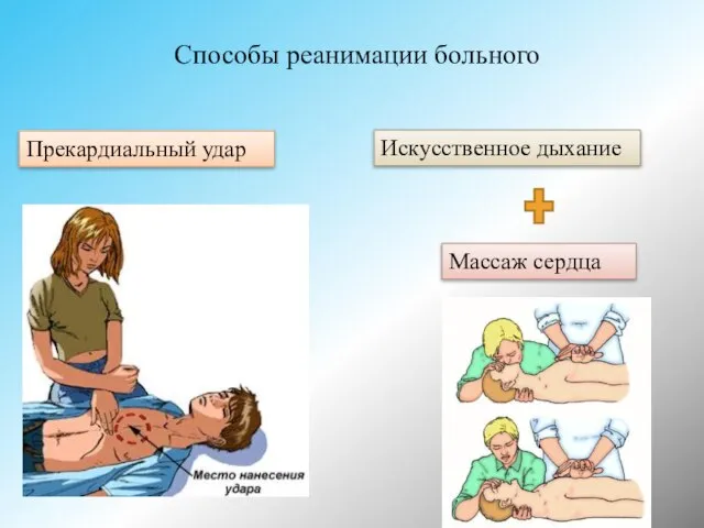 Способы реанимации больного Прекардиальный удар Массаж сердца Искусственное дыхание