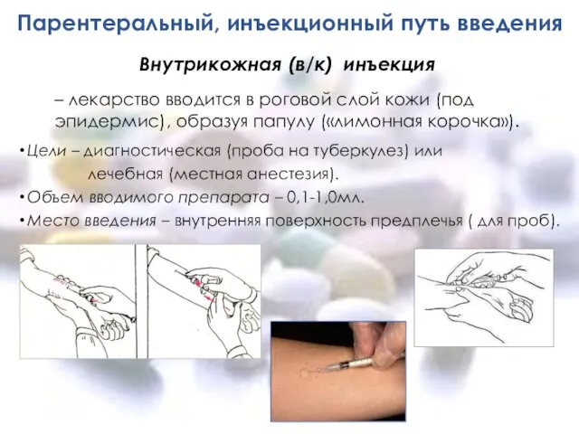 Парентеральный, инъекционный путь введения Цели – диагностическая (проба на туберкулез) или лечебная