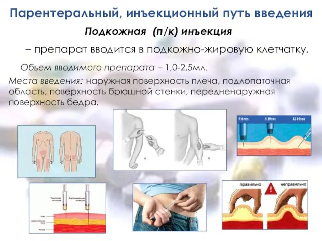 Парентеральный, инъекционный путь введения Объем вводимого препарата – 1,0-2,5мл. Места введения: наружная