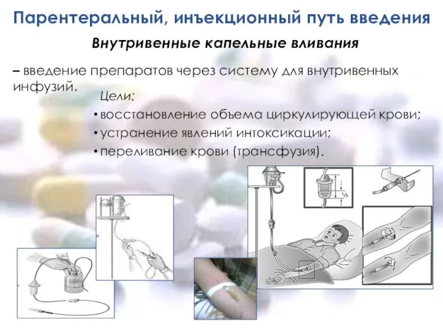 Парентеральный, инъекционный путь введения Цели: восстановление объема циркулирующей крови; устранение явлений интоксикации;