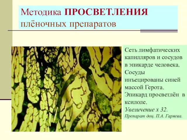 Методика ПРОСВЕТЛЕНИЯ плёночных препаратов Сеть лимфатических капилляров и сосудов в эпикарде человека.