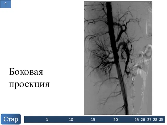 Боковая проекция Старт 10 20 15 5 25 26 27 28 29 4