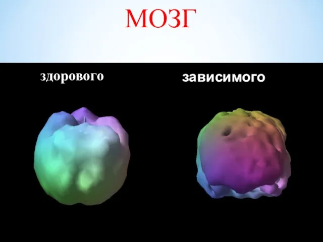 здорового зависимого МОЗГ