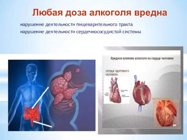 Любая доза алкоголя вредна нарушение деятельности пищеварительного тракта нарушение деятельности сердечнососудистой системы