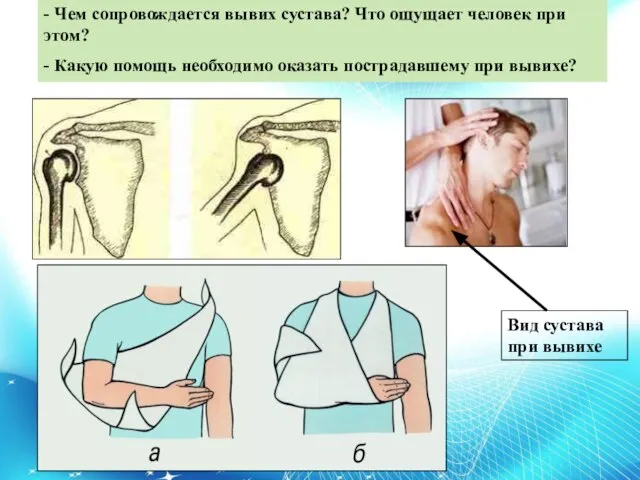 - Чем сопровождается вывих сустава? Что ощущает человек при этом? - Какую