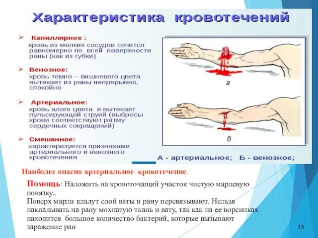 Помощь: Наложить на кровоточащий участок чистую марлевую повязку.. Поверх марли кладут слой