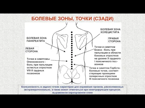 БОЛЕВЫЕ ЗОНЫ, ТОЧКИ (СЗАДИ)