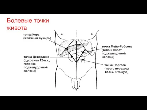 Болевые точки живота