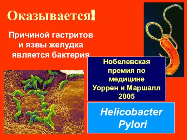 Оказывается! Причиной гастритов и язвы желудка является бактерия Helicobacter Pylori Нобелевская премия