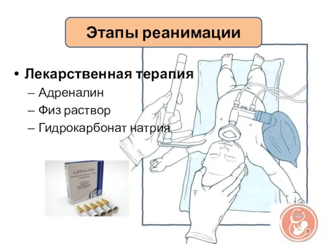 Лекарственная терапия Адреналин Физ раствор Гидрокарбонат натрия Этапы реанимации