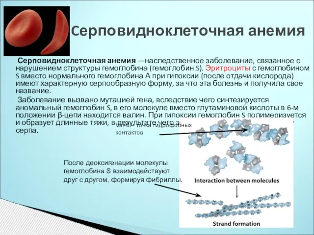 Серповидноклеточная анемия —наследственное заболевание, связанное с нарушением структуры гемоглобина (гемоглобин S). Эритроциты