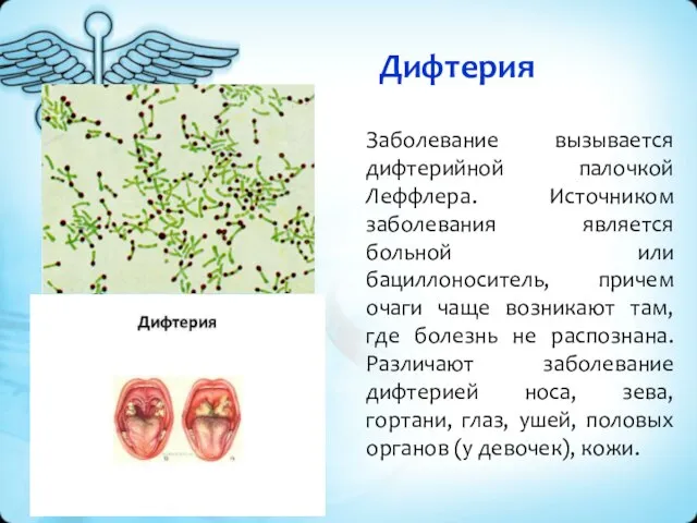 Дифтерия Заболевание вызывается дифтерийной палочкой Леффлера. Источником заболевания является больной или бациллоноситель,