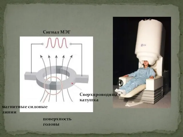 Сигнал МЭГ магнитные силовые линии поверхность головы Сверхпроводящая катушка