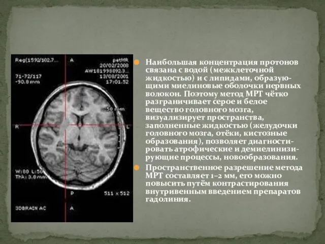 Наибольшая концентрация протонов связана с водой (межклеточной жидкостью) и с липидами, образую-щими