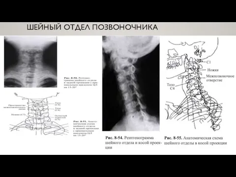 ШЕЙНЫЙ ОТДЕЛ ПОЗВОНОЧНИКА