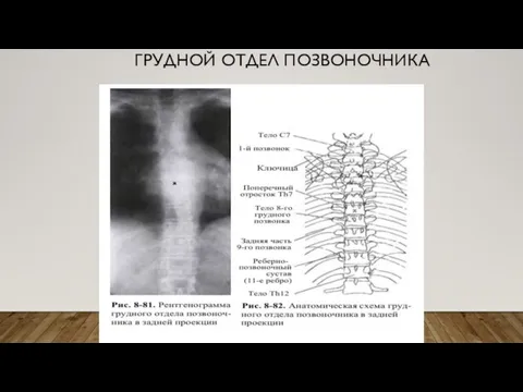 ГРУДНОЙ ОТДЕЛ ПОЗВОНОЧНИКА