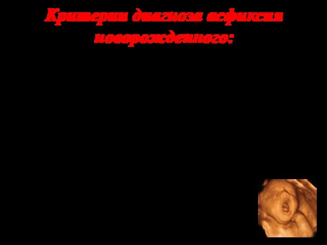 Критерии диагноза асфиксия новорожденного: 1) низкая оценка по шкале Аппгар на 1