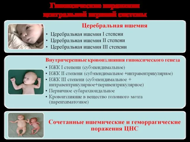 Гипоксические поражения центральной нервной системы