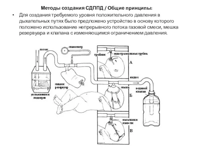 Методы создания СДППД / Общие принципы: Для создания требуемого уровня положительного давления