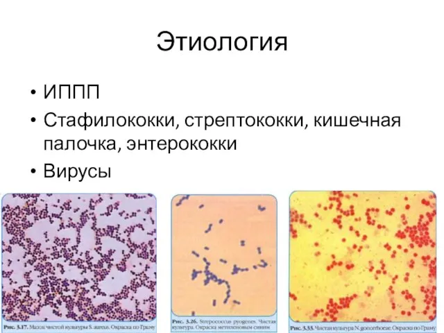 Этиология ИППП Стафилококки, стрептококки, кишечная палочка, энтерококки Вирусы