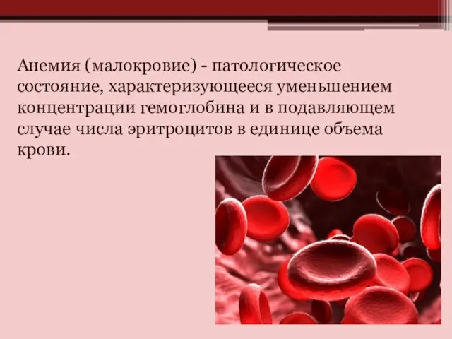 Анемия (малокровие) - патологическое состояние, характеризующееся уменьшением концентрации гемоглобина и в подавляющем