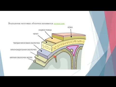 Воспаление мозговых оболочек называется менингит.