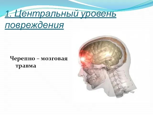1. Центральный уровень повреждения Черепно – мозговая травма